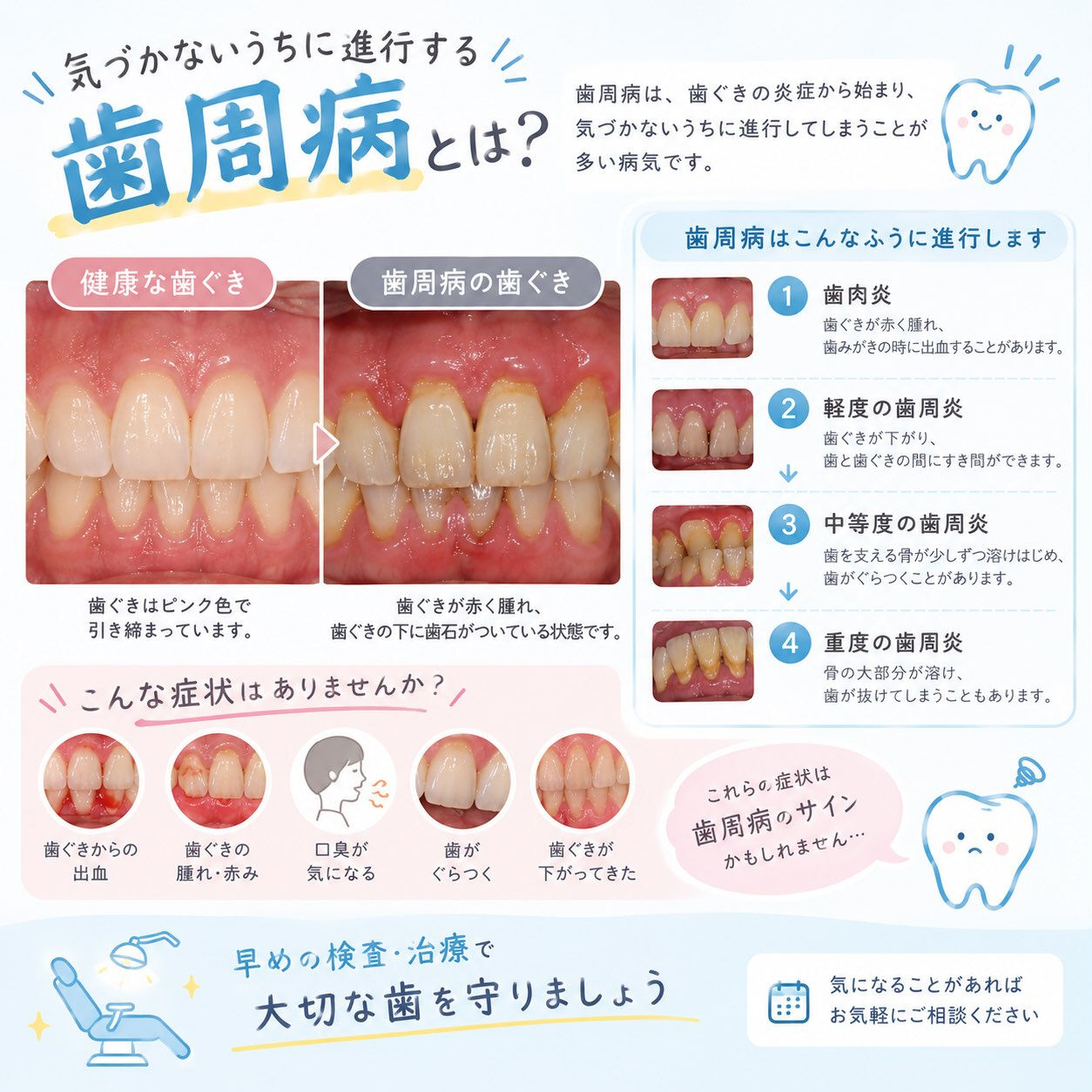 🦷 歯周病とは？